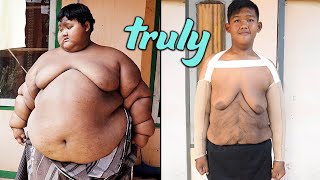 World’s Heaviest Kid Has Saggy Skin Surgery  TRULY [upl. by Rbma]