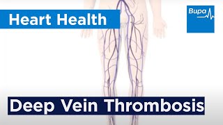 How deep vein thrombosis DVT forms  Bupa Health [upl. by Oirramaj]