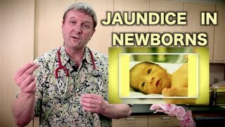 Jaundice in Newborns Pediatric Advice [upl. by Gnoix738]