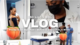 BBL VLOG  Body Reveal 🍑  360 Lipo  BBL in Miami FL  Dr Jonathan Fisher  Maya Galore [upl. by Marlette]