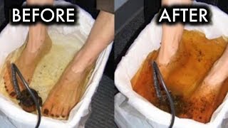 4 Natural Ways To Remove Tons Of Toxins From Your Body Through Your Feet [upl. by Almat]