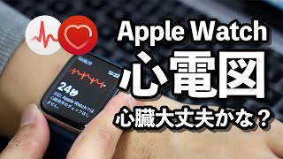 Apple Watch 心電図測定で何が分かる？【計測方法と使い方】 [upl. by Eecyac]