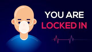 What is Lockedin Syndrome Symptoms Causes amp Treatments [upl. by Nahshun]