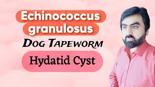 Lec15  Echinococcus granulosus  Hydatid Cyst  Life cycle  Cinical finding  Lab diagnosis Eng [upl. by Kayla]