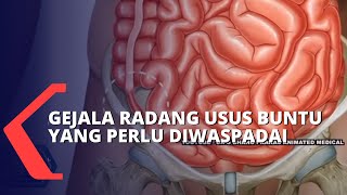 Pahami Gejala Penyebab Hingga Cara Mencegah Radang Usus Buntu [upl. by Nonnah808]