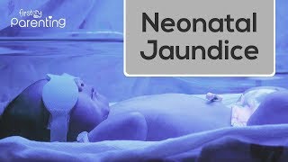 Neonatal Jaundice  Causes Symptoms and Treatment [upl. by Zipah538]