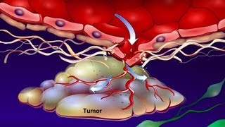 Introduction to Cancer Biology Part 4 Angiogenesis [upl. by Gatian]