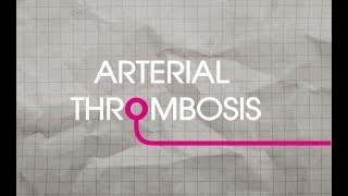 Arterial Thrombosis Explained [upl. by Austina270]