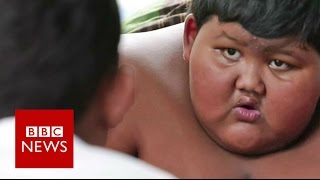 My 10yearold son weighs 188kg  BBC News [upl. by Guillema]