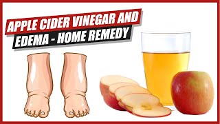 Apple Cider Vinegar and Edema  Home Remedy [upl. by Imer]