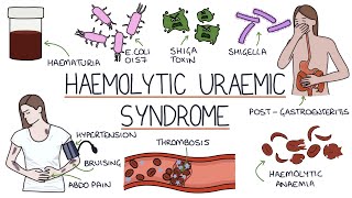 Haemolytic Uraemic Syndrome [upl. by Alyehc]