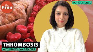 What is thrombosis [upl. by Leiad]