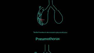 Tactile Fremitus Explained [upl. by Fairbanks]