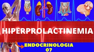 HIPERPROLACTINEMIA AUMENTO DE PROLACTINA  ENDOCRINOLOGIA [upl. by Anauj]