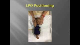 Pediatric Upper GI Fluoroscopy exam [upl. by Nuyh]