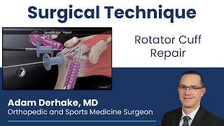 Rotator Cuff Repair Surgical Technique [upl. by Ricker]