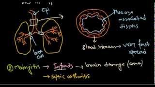 Haemophilus influenzae infection [upl. by Nwahsyar475]