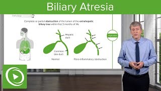 Extrahepatic biliary apparatus [upl. by Yvor]