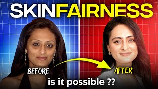 Fairness cream  Do they work  How to lighten skin tone  Dermatologist [upl. by Violet]