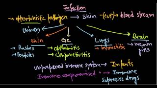 Pseudomonas aeruginosa infection [upl. by Mia]