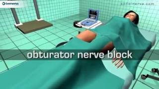 Obturator Nerve Block [upl. by Jobi]