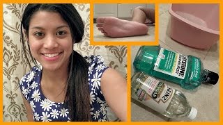 DIY Dry Foot Remedy Review [upl. by Novick]