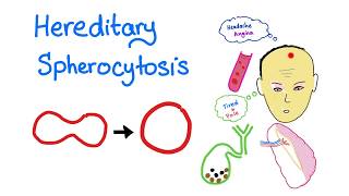 HELLP Syndrome  Hemolysis Elevated Liver Low Platelets  Hematology [upl. by Azeria]