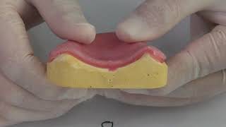 Denture Relining Rebase [upl. by Horner]