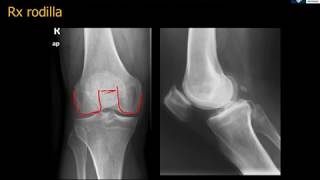 Anatomía Rx Rodilla [upl. by Einnor]