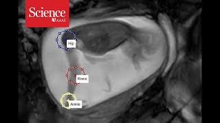 Snippet Tracking fetal movements at 24 weeks [upl. by Anesor]