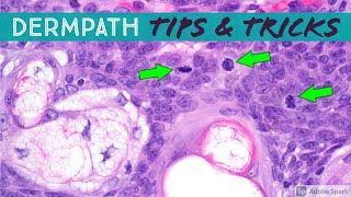 Dermatopathology Practical Tips amp Tricks for Pathology amp Dermatology [upl. by Lapides]