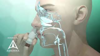 Fluticasone nasal spray Flonase  3D medical animation [upl. by Rodrigo12]