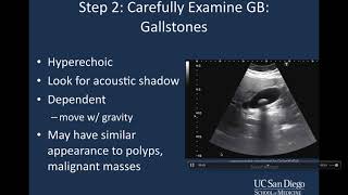 Bilirubin  Part 1 Metabolism amp Excretion [upl. by Bohaty644]