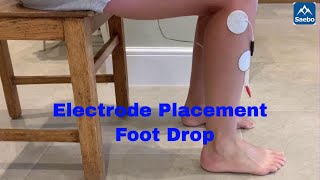 Electrode Placement for foot drop [upl. by Schumer154]