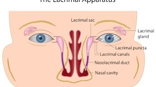 Nasolacrimal Duct Obstruction [upl. by Searcy598]