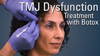 TMJ Dysfunction Treatment with Botox®  Sneak Preview [upl. by Safir421]