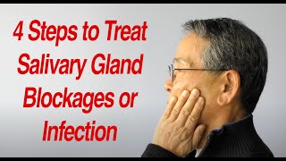 4 Steps to Treat Salivary Gland Swelling at Home [upl. by Anual]