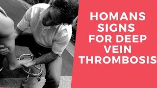 Homans Sign for Deep Vein Thrombosis [upl. by Monarski666]