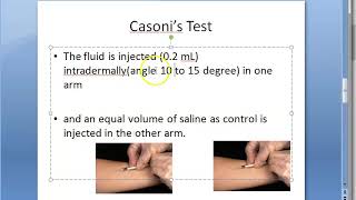 Parasitology 143 a Casoni Test Skin Hydatid disease Intradermal injection Echinococcus granulosus [upl. by Leryt975]