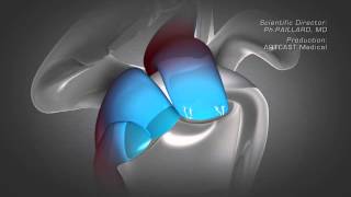 Shoulder Arthroscopy  Rotator Cuff Repair [upl. by Ainatnas803]