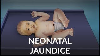 Neonatal Jaundice by L Veit  OPENPediatrics [upl. by Ad]