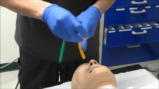 Nasal Intubation [upl. by Gerk]