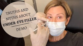 UNDER EYE FILLERS Before amp After  Restylane Results Truths amp MYTHS  Dominique Sachse [upl. by Nnylecoj]