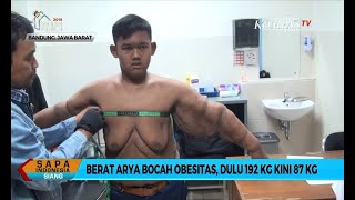 Berat Badan Turun Lebih dari 100 Kg Arya Permana Akan Operasi Plastik untuk Buang Kulit Gelambir [upl. by Hctub]