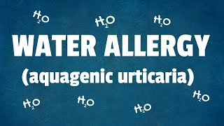 Water Allergy 10 Interesting Facts About Aquagenic Urticaria [upl. by Hardner]