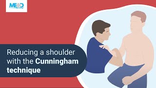 Reducing a shoulder with the Cunningham technique [upl. by Estella]